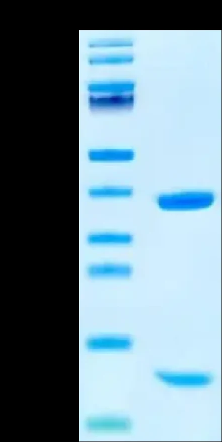 CMVPP65-HP001 Bis-Tris-PAGE result