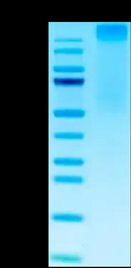CMVPP65-HP003 Bis-Tris-PAGE result