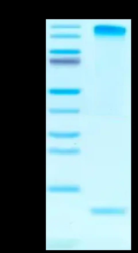 CMVPP65-HP004 Bis-Tris-PAGE result