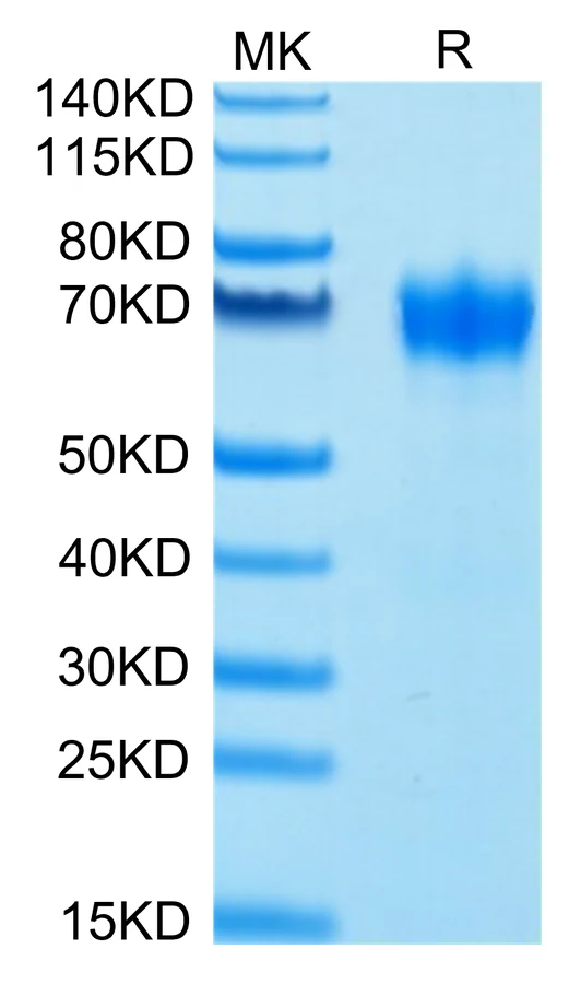 CSF-HB003 Bis-Tris-PAGE-white result