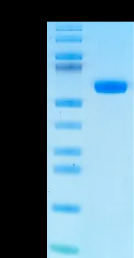 CT83-HB001 Bis-Tris-PAGE result