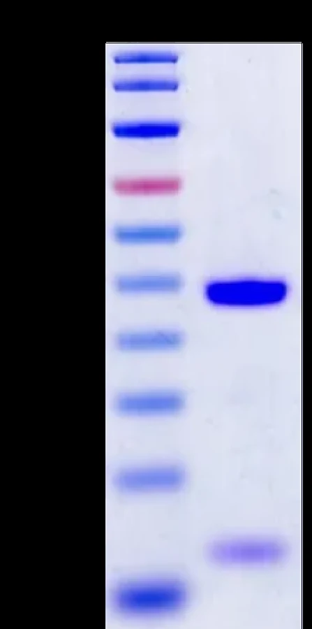 CT83-HB002 Bis-Tris-PAGE result