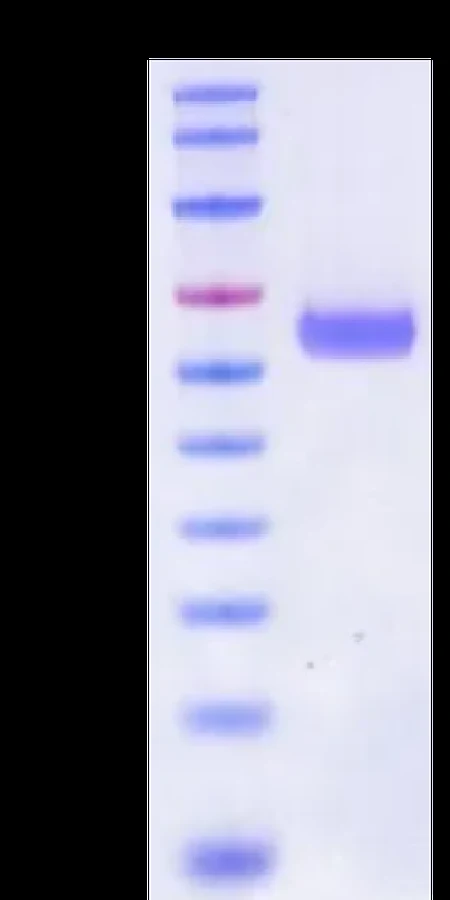 CT83-HB003 Bis-Tris-PAGE result