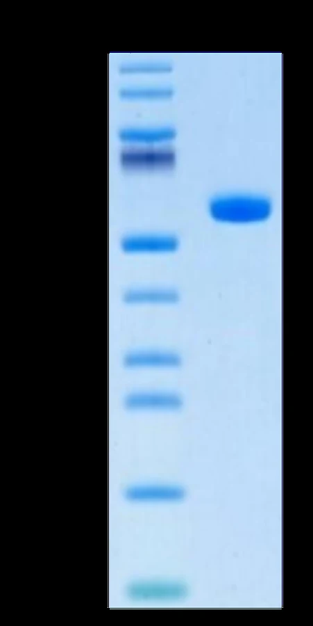 CT83-HP001 Bis-Tris-PAGE result