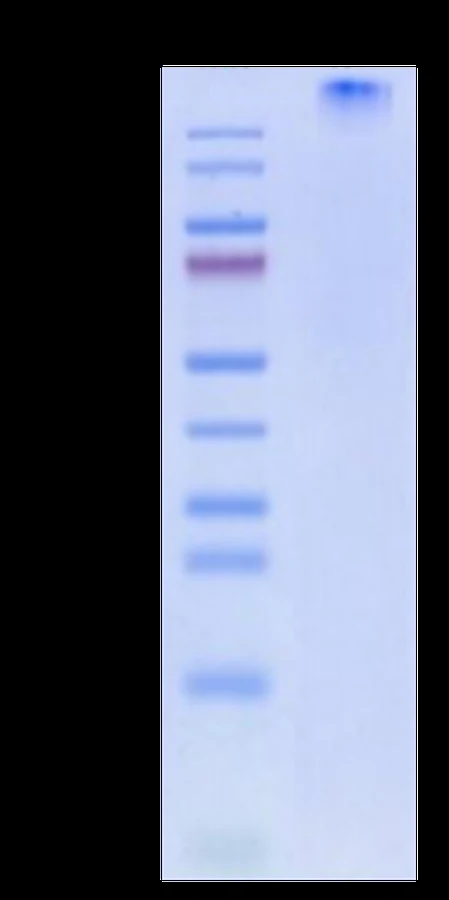CT83-HP002 Bis-Tris-PAGE result