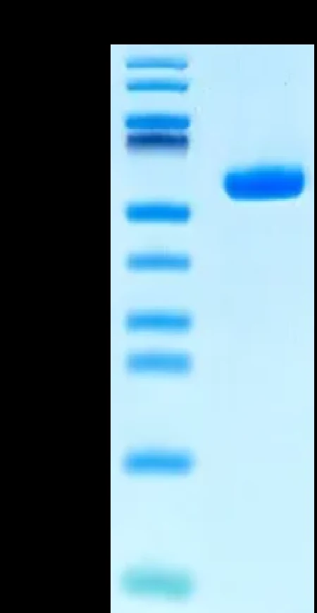 CT83-HP003 Bis-Tris-PAGE result