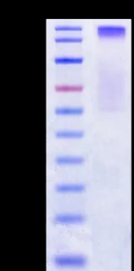 CT83-HP004 Bis-Tris-PAGE result