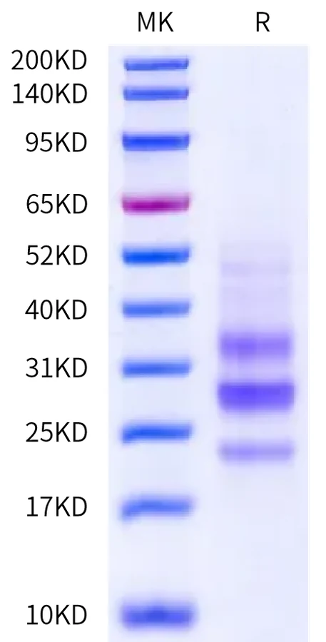 CTLA8-CB001 Bis-Tris-PAGE-white result