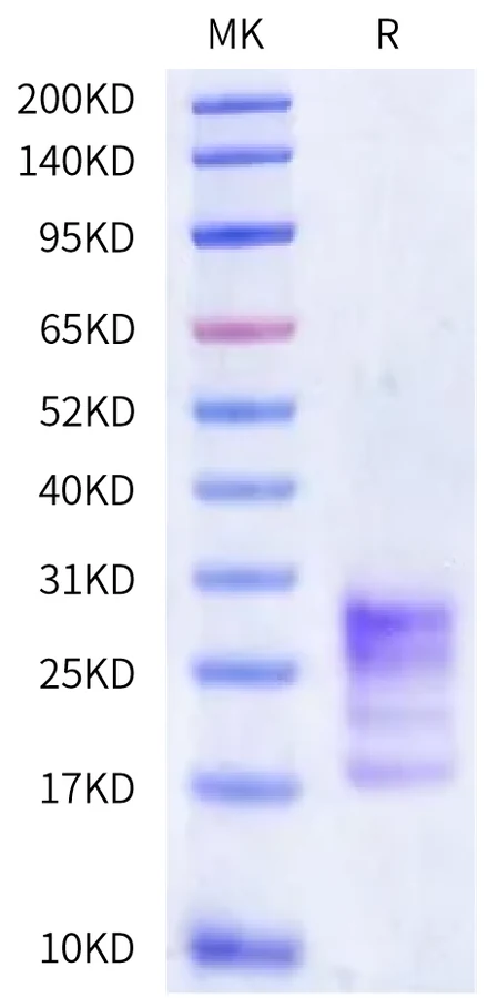 CTLA8-HB001 Bis-Tris-PAGE-white result