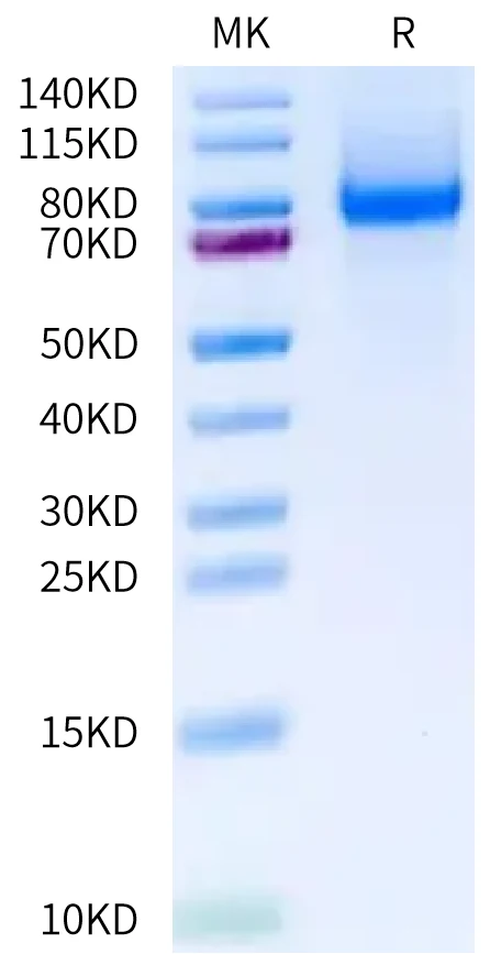 CXCL16-HF001 Bis-Tris-PAGE-white result