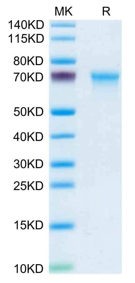 CXCL16-MF001 Bis-Tris-PAGE-white result
