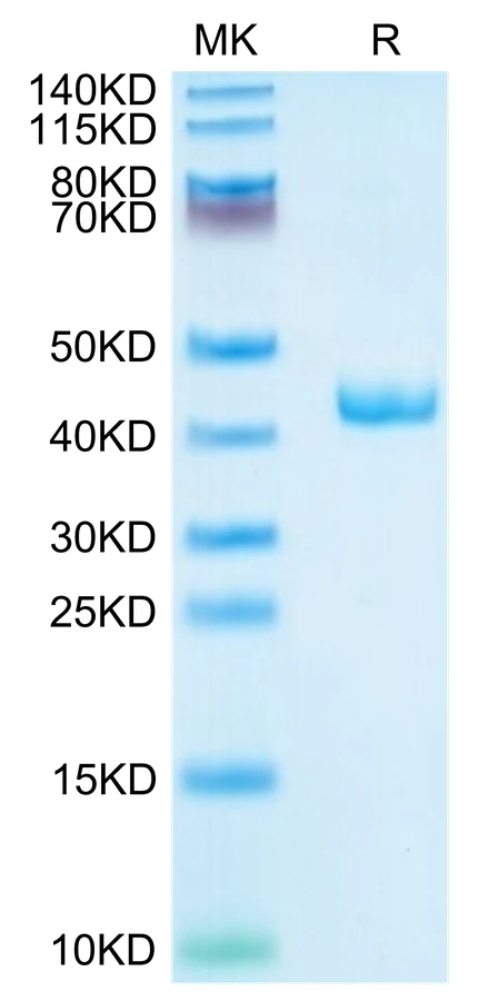 CXCL4-HF001 Bis-Tris-PAGE-white result
