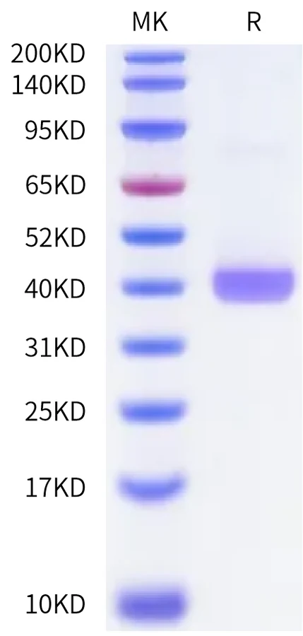 CXCL5-HF001 Bis-Tris-PAGE-white result