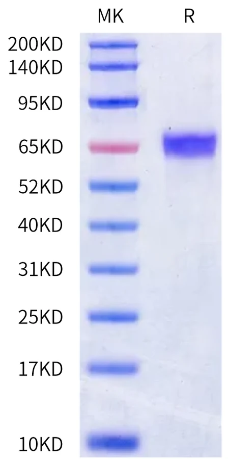 DDR1-HB001 Bis-Tris-PAGE-white result