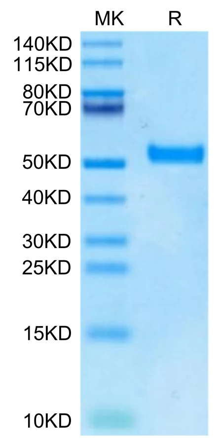 DKK1-HB003 Bis-Tris-PAGE-white result