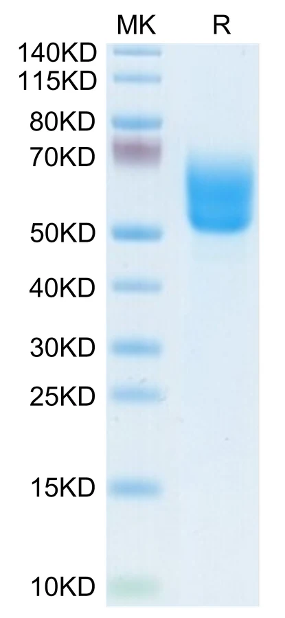 DKK3-HB001 Bis-Tris-PAGE-white result