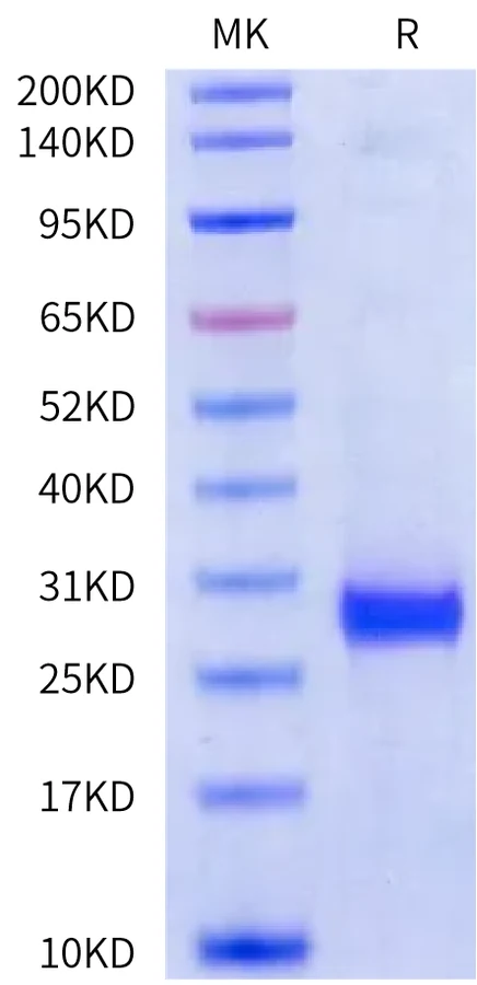DLL3-HB005 Bis-Tris-PAGE-white result