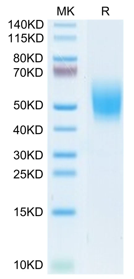 DNAM1-CP002 Bis-Tris-PAGE-white result