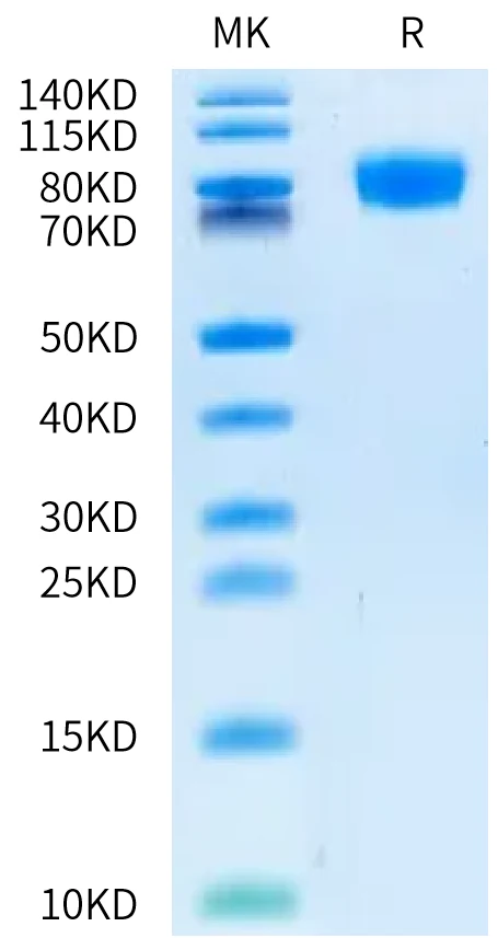 DNAM1-HP002 Bis-Tris-PAGE-white result