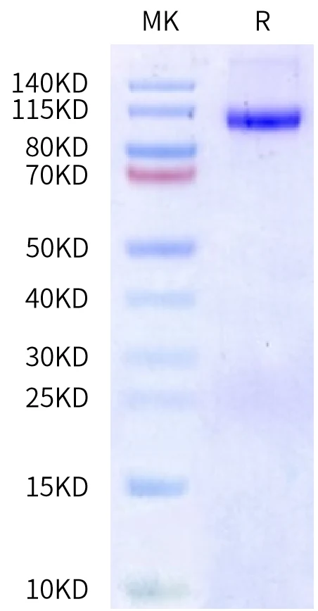 DPPIV-HB003 Bis-Tris-PAGE-white result