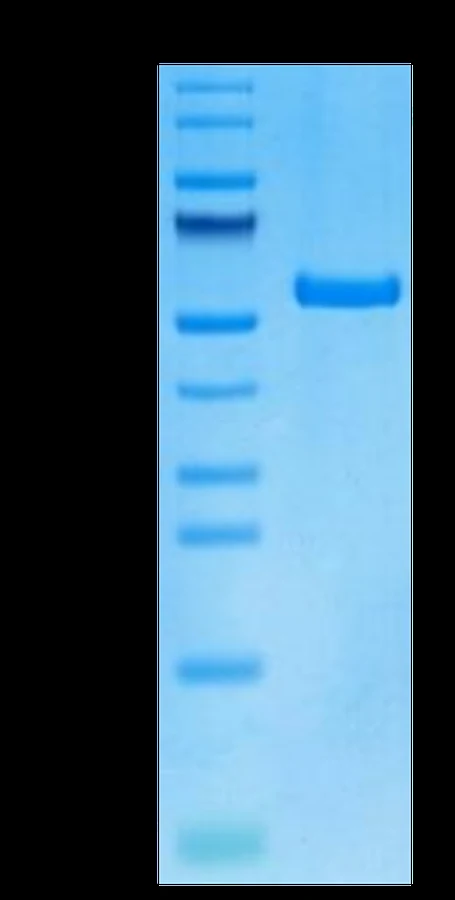 DSG3-HP001 Bis-Tris-PAGE result