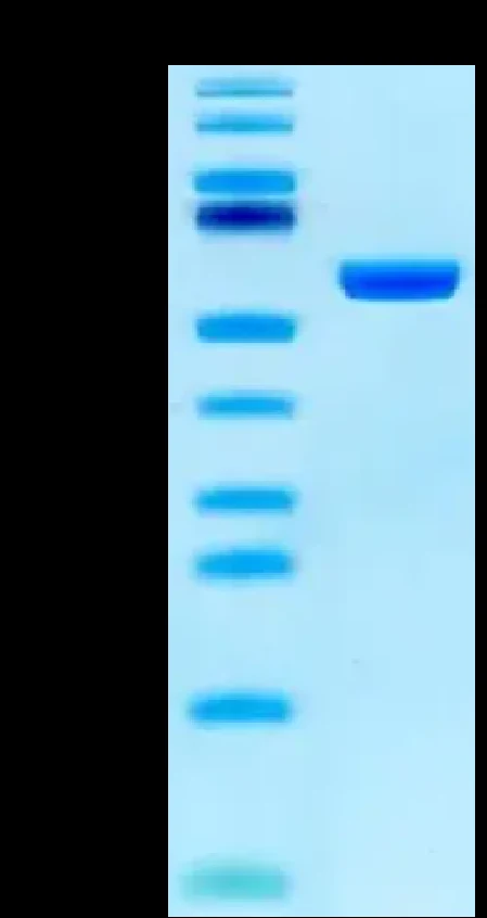 EBVLMP1-HB001 Bis-Tris-PAGE result