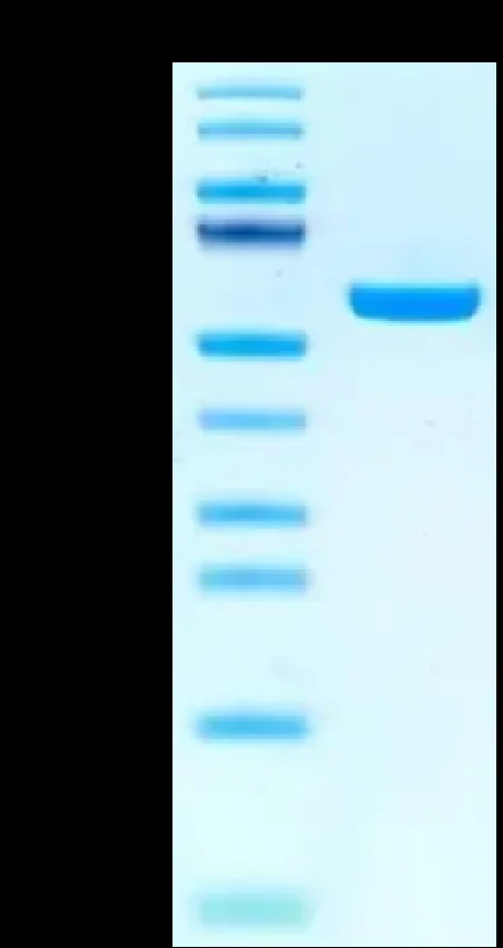 EBVLMP1-HP001 Bis-Tris-PAGE result