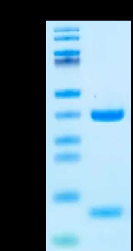 EGFRL858R-HB001 Bis-Tris-PAGE result