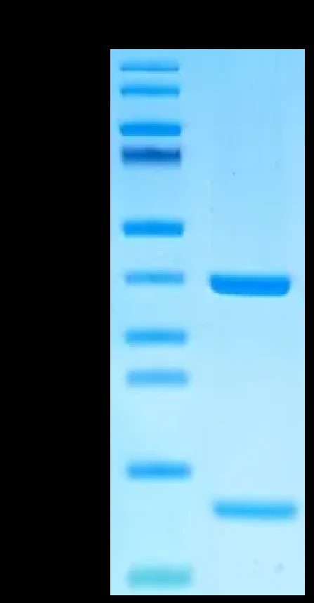 EGFRL858R-HP001 Bis-Tris-PAGE result