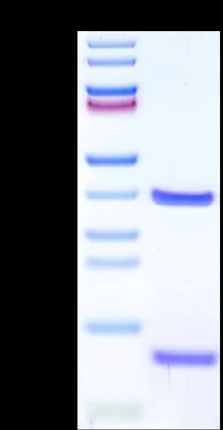 EGFRWT-HP001 Bis-Tris-PAGE result