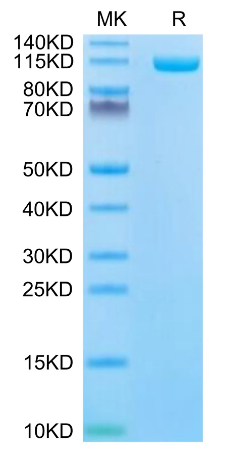 ENPP1-HB001 Bis-Tris-PAGE-white result