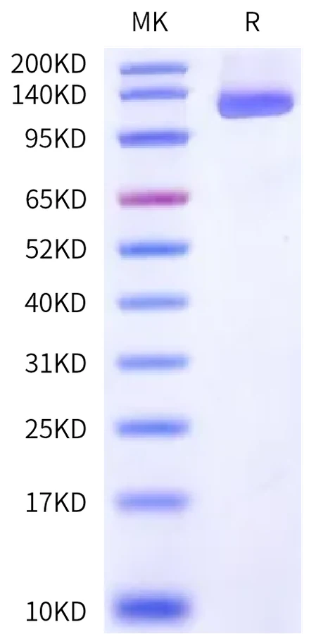 ENPP3-HB001 Bis-Tris-PAGE-white result
