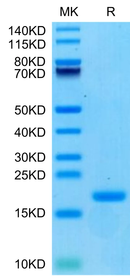 ENPP3-HB002 Bis-Tris-PAGE-white result