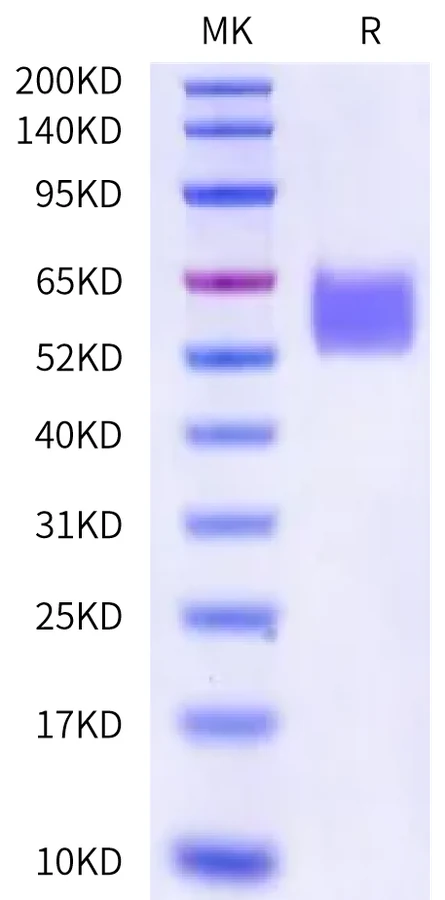 ENPP3-HB003 Bis-Tris-PAGE-white result