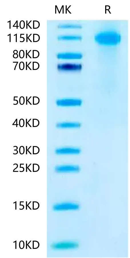 FCRH5FCRL5-HB001 Bis-Tris-PAGE-white result
