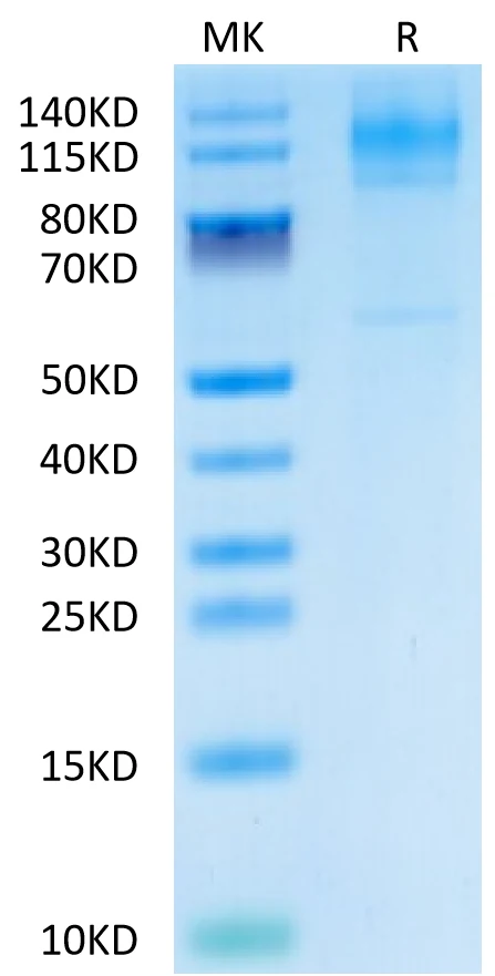 FCRH5FCRL5-HB002 Bis-Tris-PAGE-white result