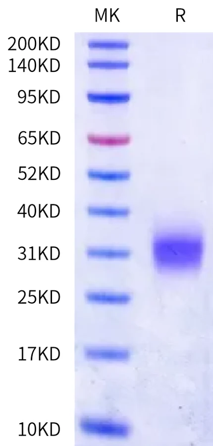 FCRH5FCRL5DOMAIN-CB001 Bis-Tris-PAGE-white result
