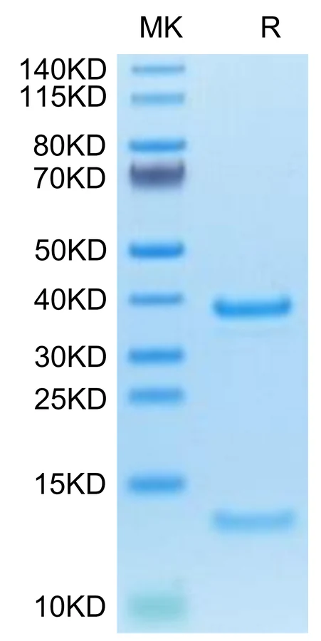 FCRN-CP001 Bis-Tris-PAGE-white result