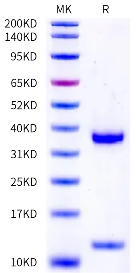 FCRN-HP001 Bis-Tris-PAGE-white result