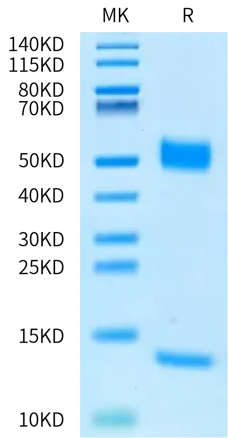 FCRN-RB001 Bis-Tris-PAGE-white result