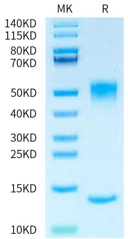 FCRN-RP001 Bis-Tris-PAGE-white result