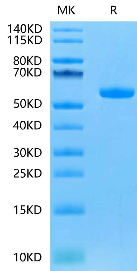 FGF21-HP001 Bis-Tris-PAGE-white result