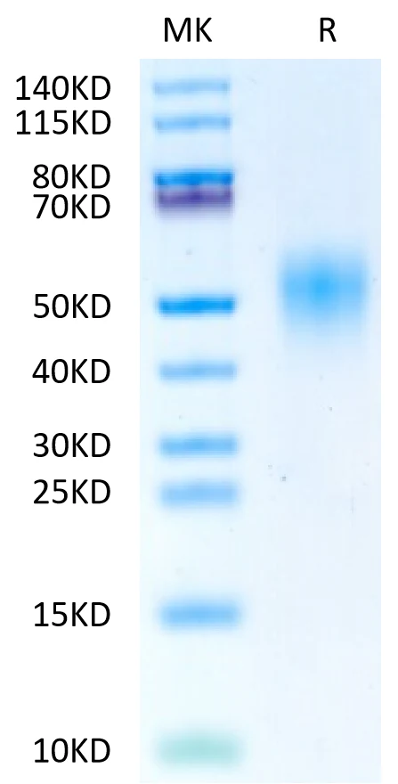 FGFR4-HB002 Bis-Tris-PAGE-white result