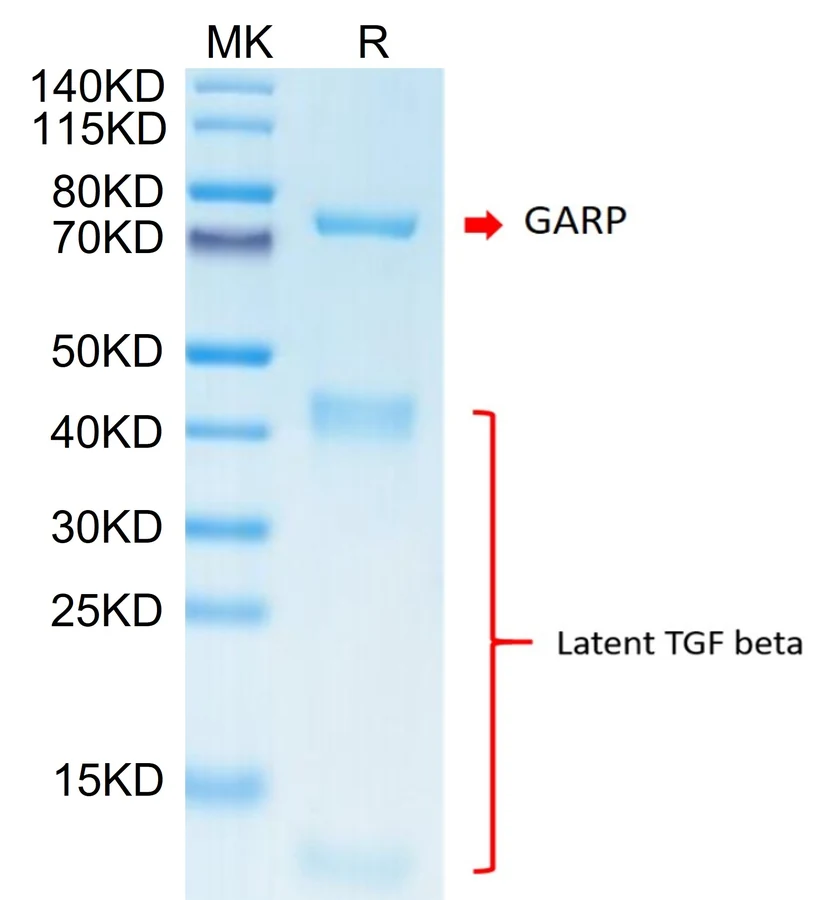 GARP-CB001 Bis-Tris-PAGE result