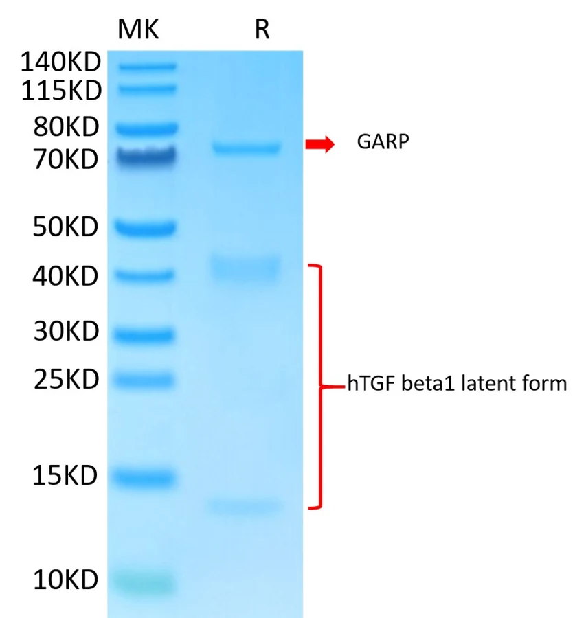 GARP-HB001 Bis-Tris-PAGE result