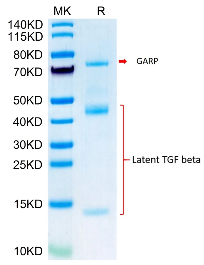 GARP-MB001 Bis-Tris-PAGE result