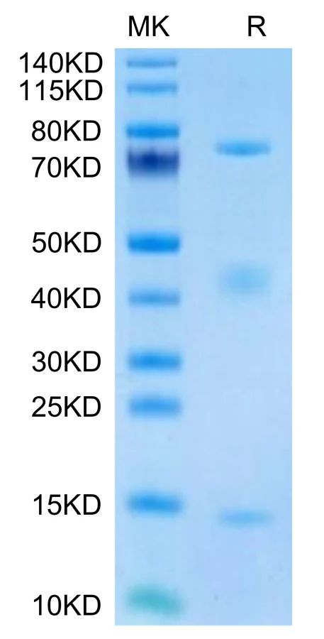 GARP-RB001 Bis-Tris-PAGE-white result