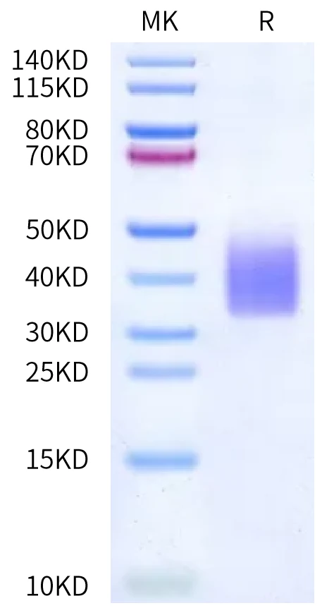 GCGR-HB002 Bis-Tris-PAGE-white result