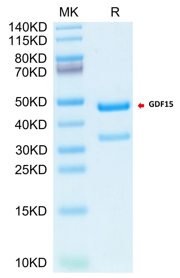 GDF15-CB001 Bis-Tris-PAGE result
