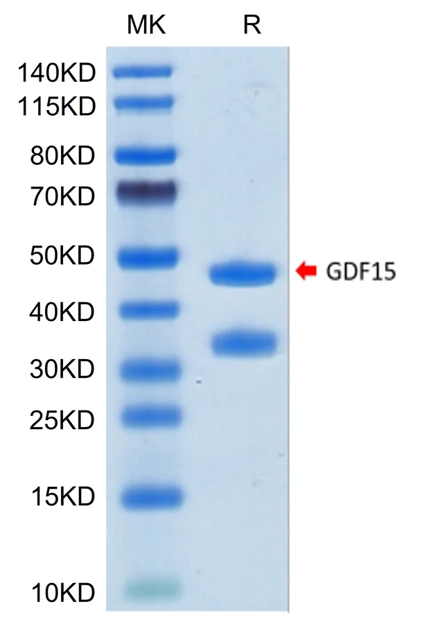 GDF15-HB002 Bis-Tris-PAGE result